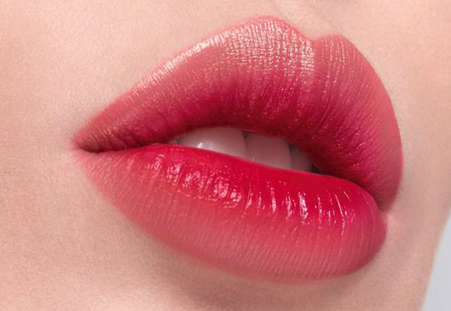 lip filler alanya