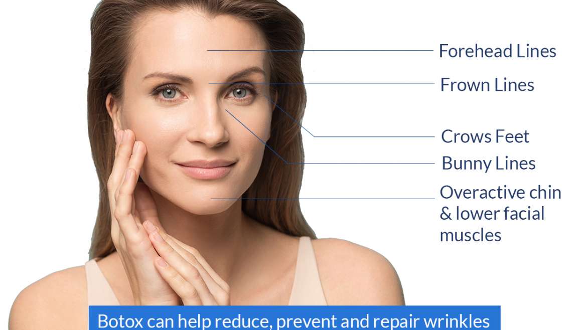 Alanya Aesthetic Botox for wrinkless