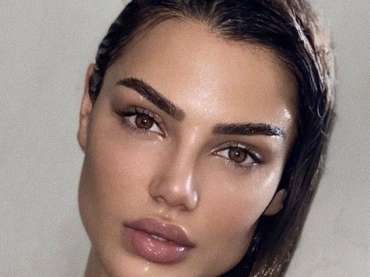 Natural and Long term lip augmentation