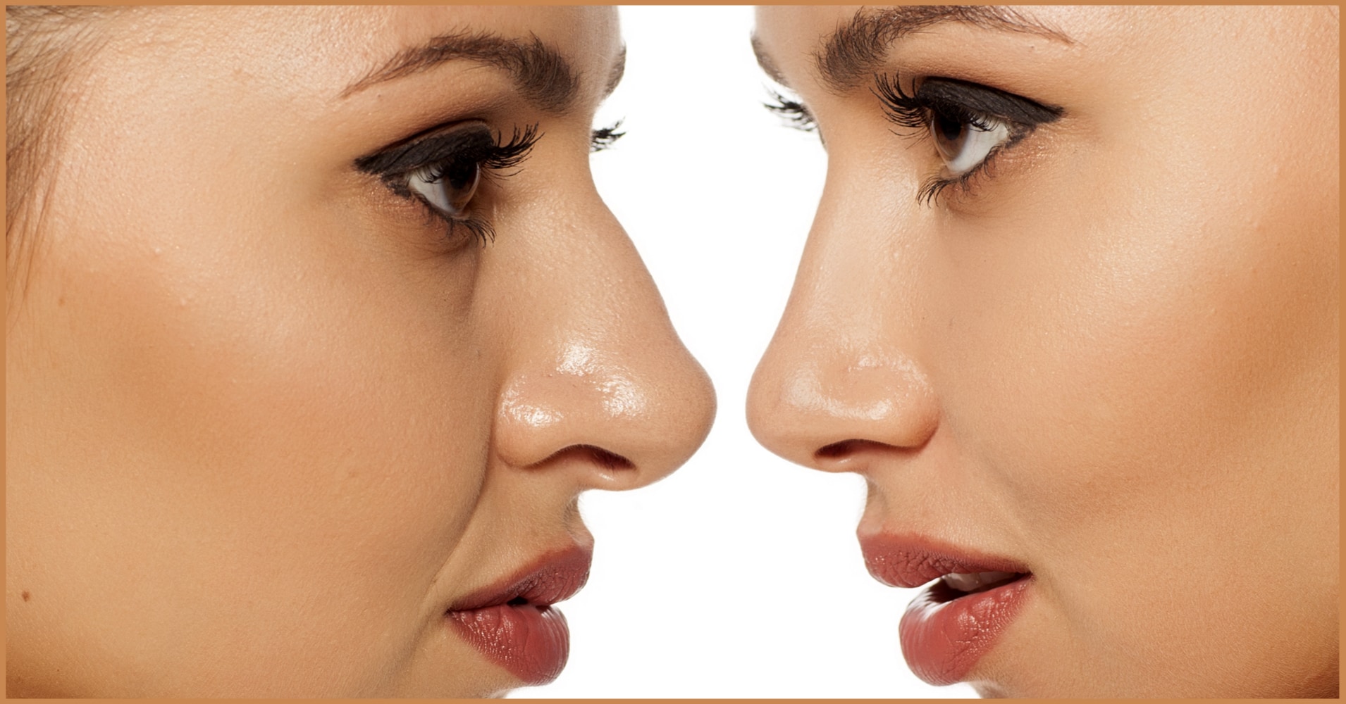 nose filler alanya
