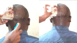 Use a scissors to cut the bandage